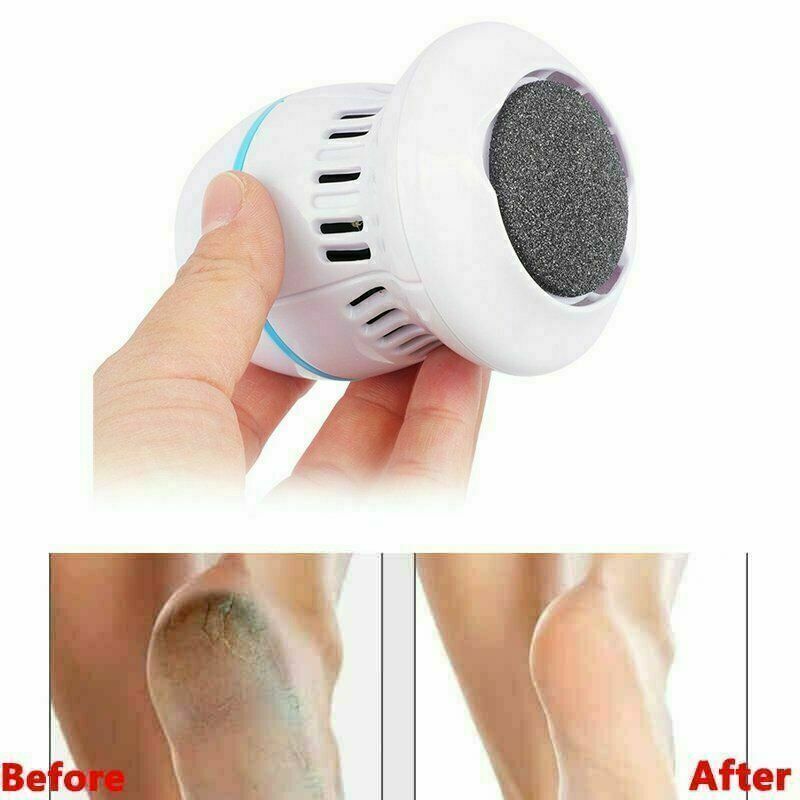 RIMUOVI CALLI ELETTRICO PROFESSIONALE PIEDI PEDICURE PER CALLI E DURONI PLUS